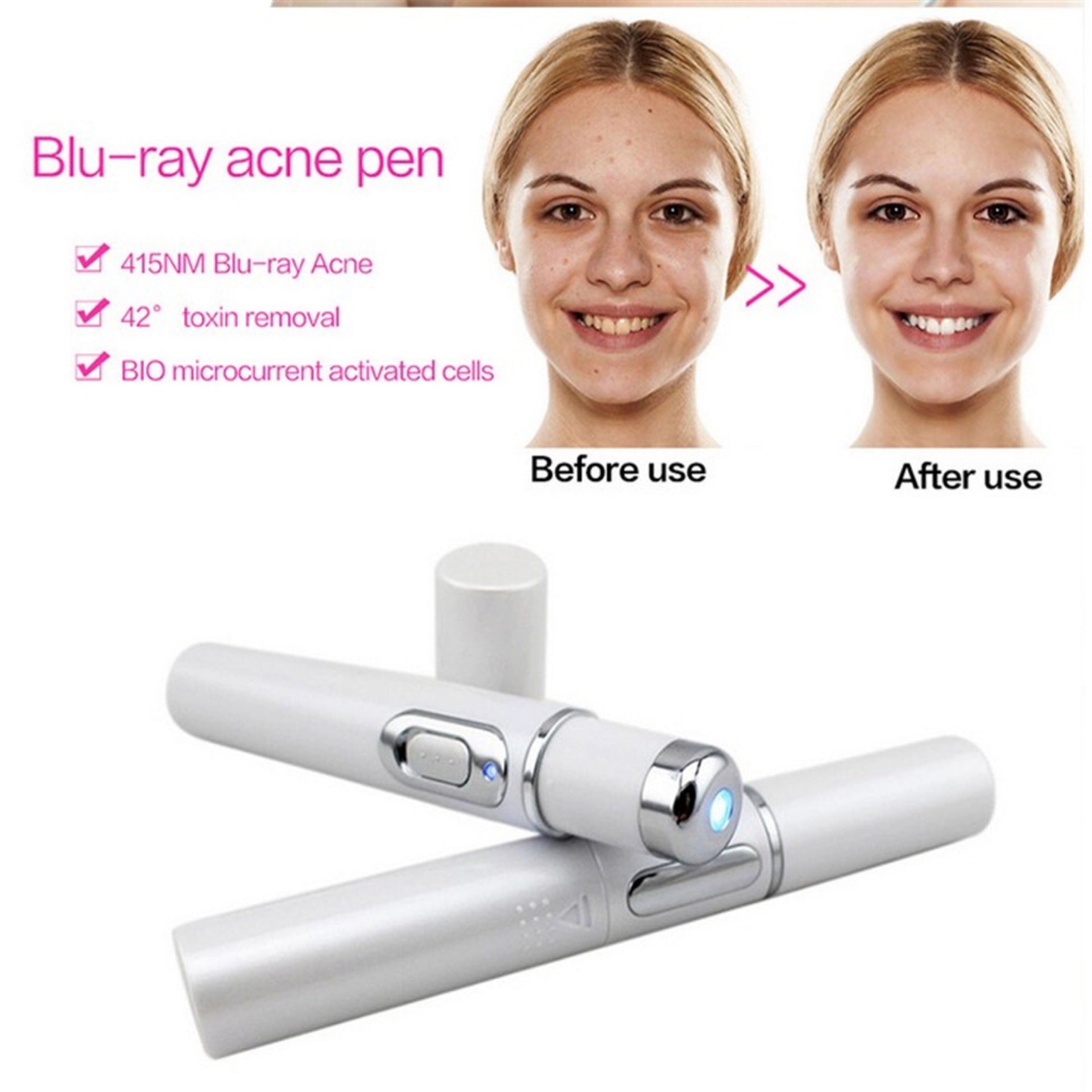 Dispositivo de tratamiento con láser para el acné, terapia de luz azul, eliminación de arrugas y cicatrices, equipo de belleza para el cuidado de la piel.