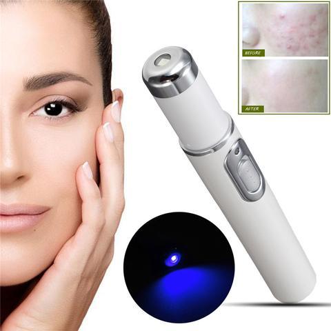 Dispositivo de tratamiento con láser para el acné, terapia de luz azul, eliminación de arrugas y cicatrices, equipo de belleza para el cuidado de la piel.