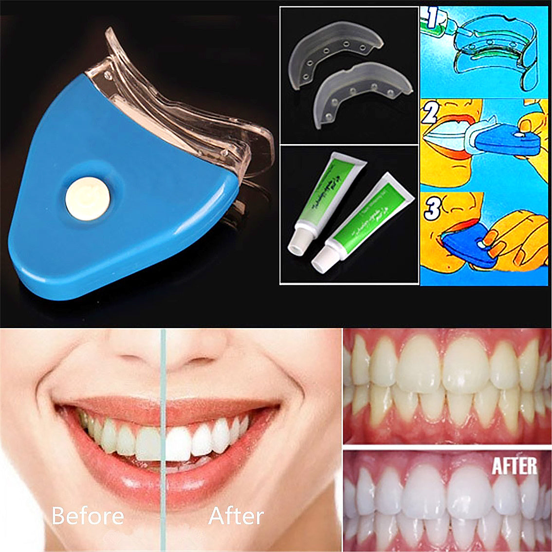 Blanqueador Dental Blanqueador Dental LED+Gel Oral